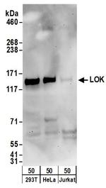 LOK Polyclonal Antibody