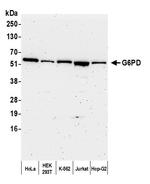 G6PD Polyclonal Antibody