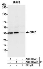 CDK7 Antibody in Immunoprecipitation (IP)