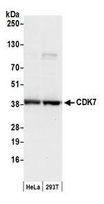 CDK7 Antibody in Western Blot (WB)