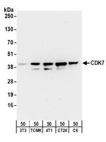 CDK7 Antibody in Western Blot (WB)