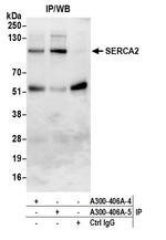 SERCA2 Antibody in Immunoprecipitation (IP)
