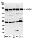 SERCA2 Polyclonal Antibody