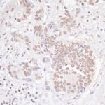 TBLR1 Polyclonal Antibody