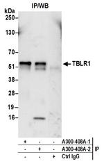TBLR1 Antibody in Immunoprecipitation (IP)