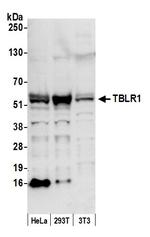 TBLR1 Antibody in Western Blot (WB)