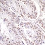 ASC2 Antibody in Immunohistochemistry (Paraffin) (IHC (P))