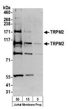 TRPM2 Polyclonal Antibody