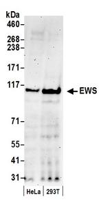 EWS Polyclonal Antibody