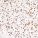 EWS Polyclonal Antibody