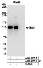 EWS Antibody in Immunoprecipitation (IP)