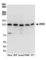 EWS Antibody in Western Blot (WB)