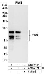 EWS Antibody in Immunoprecipitation (IP)