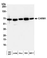 CARM1 Polyclonal Antibody