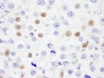 IRF3 Antibody in Immunohistochemistry (Paraffin) (IHC (P))