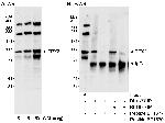 TPX2 Antibody in Western Blot (WB)