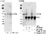 TPX2 Polyclonal Antibody