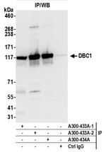 DBC1/p30 DBC Antibody in Immunoprecipitation (IP)