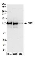 DBC1/p30 DBC Polyclonal Antibody