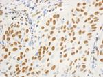 DBC1/p30 DBC Polyclonal Antibody
