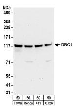 DBC1/p30 DBC Antibody in Western Blot (WB)