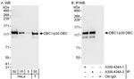 DBC1/p30 DBC Antibody in Western Blot (WB)