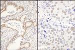 CCAR1 Antibody in Immunohistochemistry (Paraffin) (IHC (P))