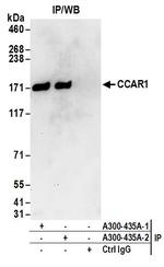 CCAR1 Antibody in Immunoprecipitation (IP)