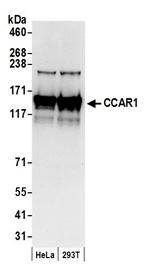 CCAR1 Polyclonal Antibody