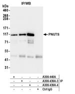 PNUTS Antibody in Immunoprecipitation (IP)