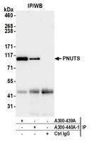 PNUTS Antibody in Immunoprecipitation (IP)