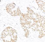 RecQ1 Polyclonal Antibody