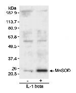 MnSOD Polyclonal Antibody