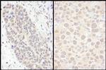 FOXO3a Antibody in Immunohistochemistry (Paraffin) (IHC (P))