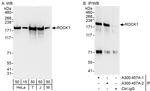 ROCK1 Polyclonal Antibody
