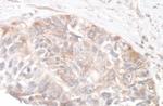 Rictor Polyclonal Antibody