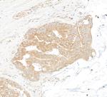 DDX6 Antibody in Immunohistochemistry (Paraffin) (IHC (P))