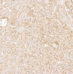 DDX6 Polyclonal Antibody