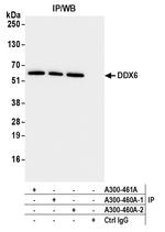 DDX6 Antibody in Immunoprecipitation (IP)
