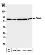 DDX6 Antibody in Western Blot (WB)