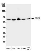DDX6 Antibody in Western Blot (WB)