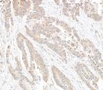 DDX6 Polyclonal Antibody
