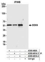 DDX6 Antibody in Immunoprecipitation (IP)