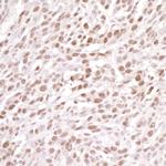 DDB1 Polyclonal Antibody