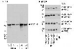 MST1-2/STK3-4 Antibody in Western Blot (WB)