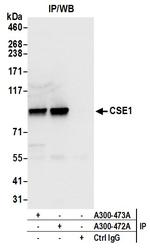 CSE1 Antibody in Immunoprecipitation (IP)