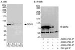 DDX3 Polyclonal Antibody