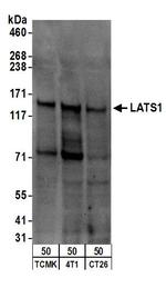 LATS1 Polyclonal Antibody
