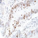 RCH1/KPNA2 Antibody in Immunohistochemistry (Paraffin) (IHC (P))