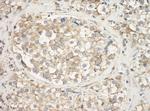 Cytoskeletal Actin Antibody in Immunohistochemistry (Paraffin) (IHC (P))